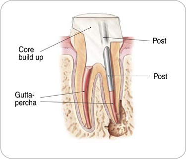 Picture of a tooth